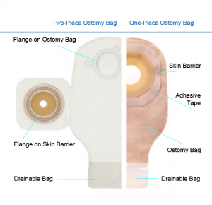 Urostomy Bag vs. Colostomy Bag: What's the Difference?